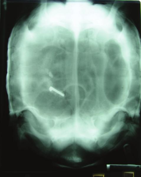 XRAY